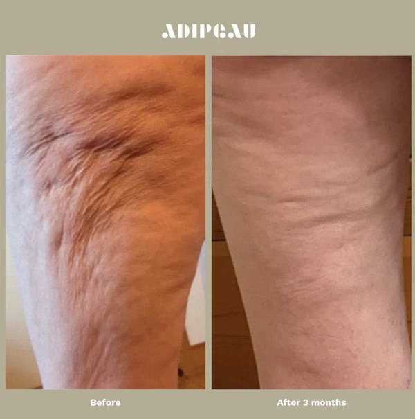 ADIPEAU STRONG BODY GEL